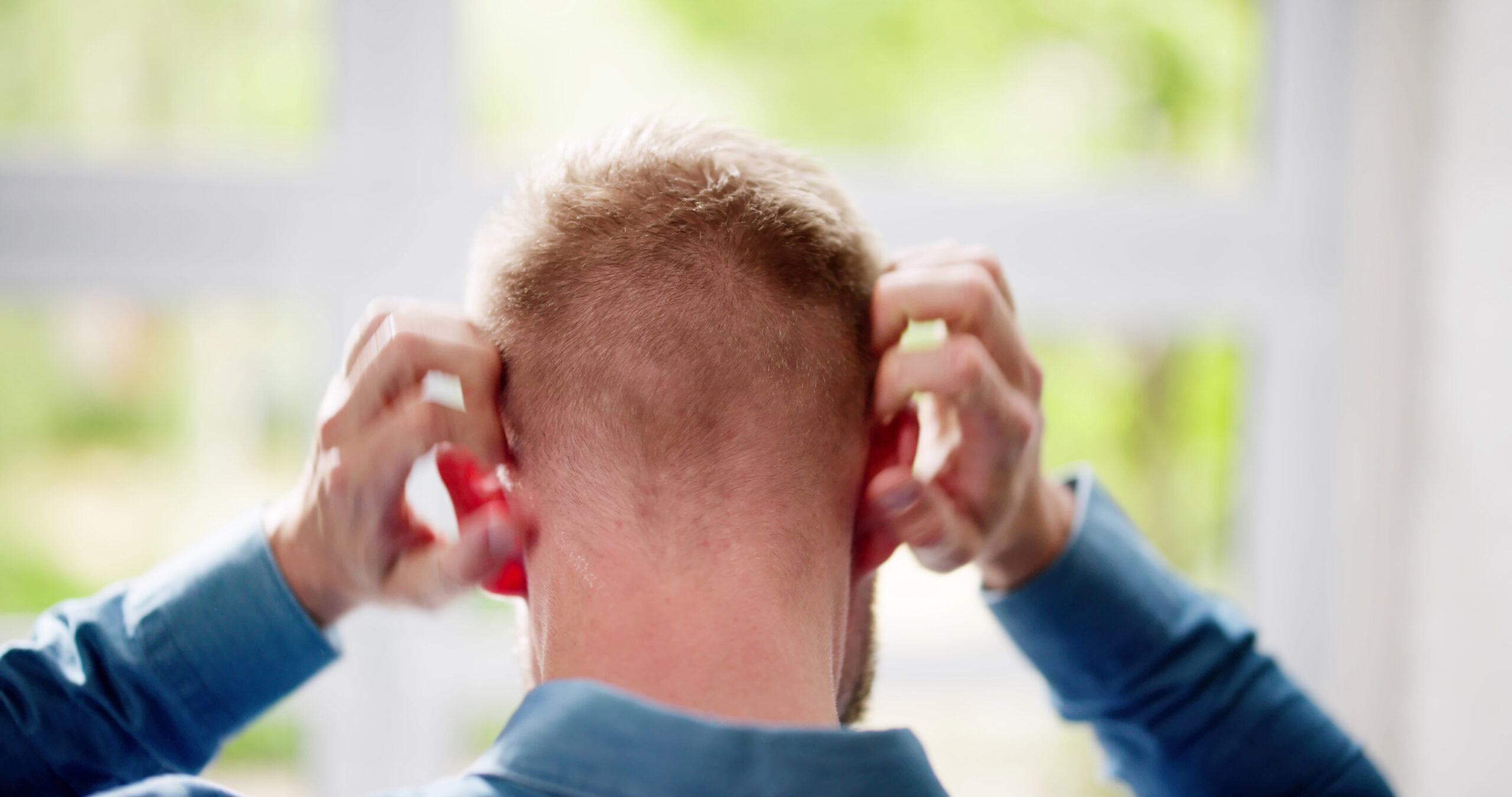 Itchy scalp from topical minoxidil