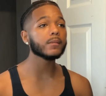 Man before and after minoxidil beard treatment