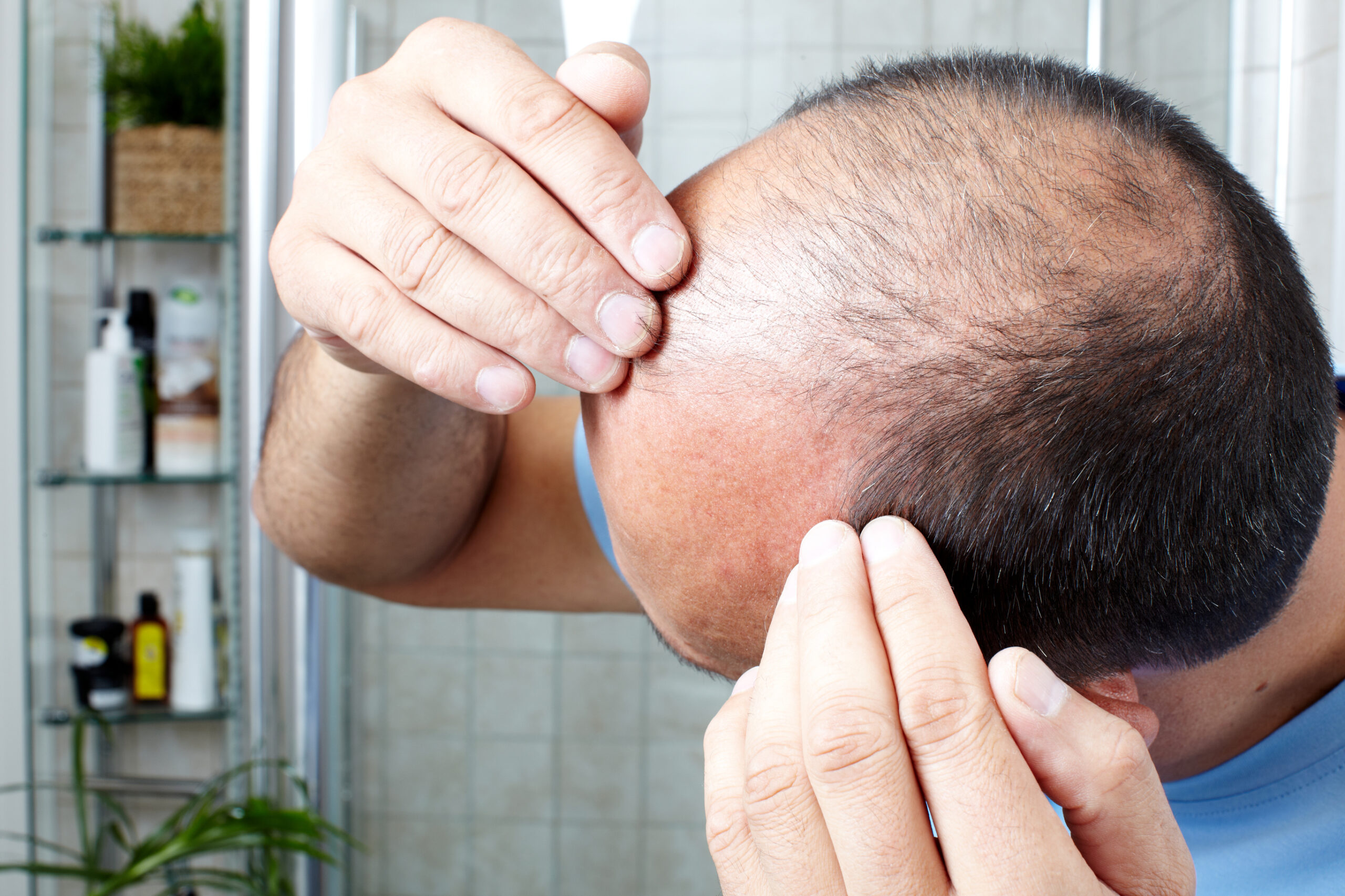 Man examining hair loss